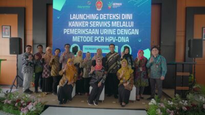 Pemda DIY – Bio Farma Kerjasama Deteksi Dini Kanker Serviks Gunakan Cerviscan